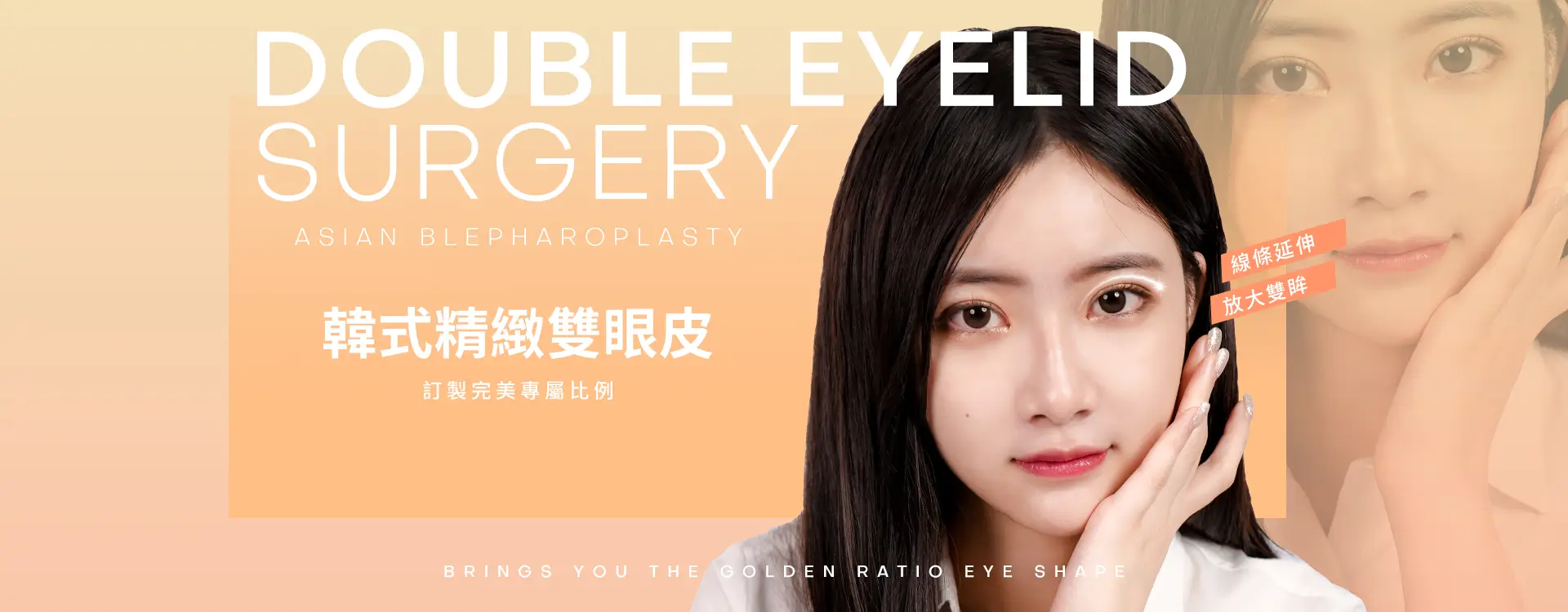 韓式精緻雙眼皮-線條延伸，放大雙眸，訂製完美專屬比例