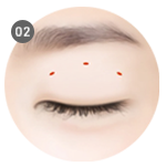 1-2mm small incision on the upper eyelid