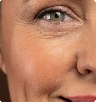 Numerous facial wrinkles