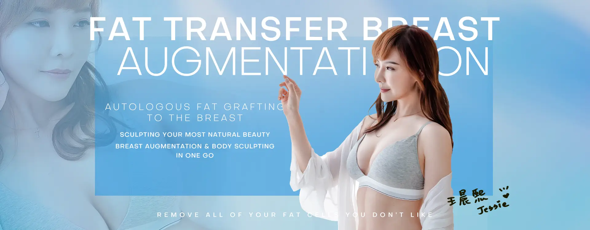 Fat Transfer Breast Augmentation (Autologous fat grafting to the breast)