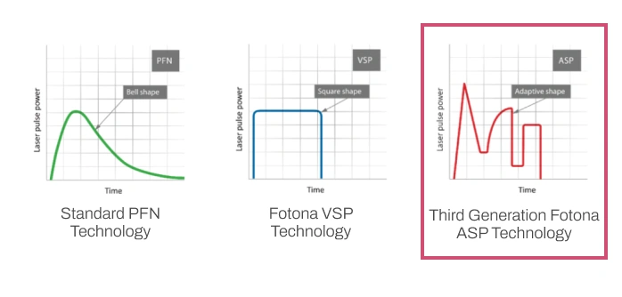 Standard PFN Tech、Fotona VSP Tech、Third Generation Fotona ASP Tech Comparison Chart